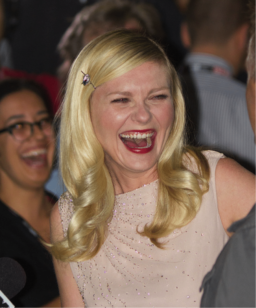 kirsten dunst teeth fixed