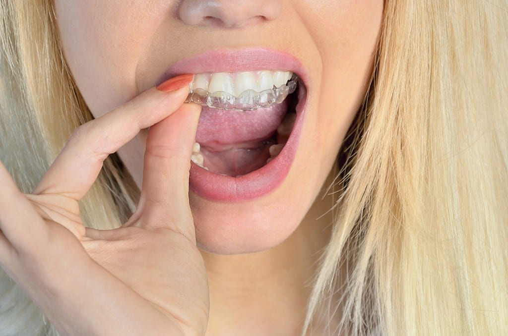 The Causes of Tooth Grinding and How to Stop It