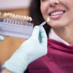 what to do after dental crown placement. Dental crown post-op care.